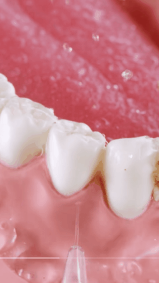 Flosser Antihalitosis Portátil